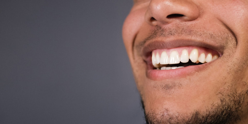 dental patient in need of gum recession treatment